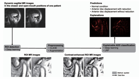 Explainable deep learning-based clinical decision support engine for MRI-based automated diagnosis of temporomandibular joint anterior disk displacement