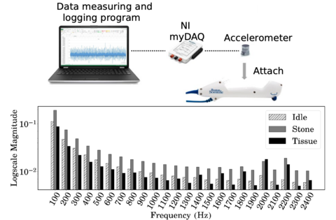 A warning system for urolithiasis via retrograde intrarenal surgery using machine learning: an experimental study