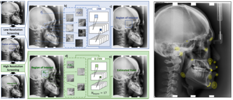 Automated cephalometric landmark detection with confidence regions using Bayesian convolutional neural networks